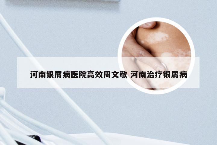 河南银屑病医院高效周文敬 河南治疗银屑病