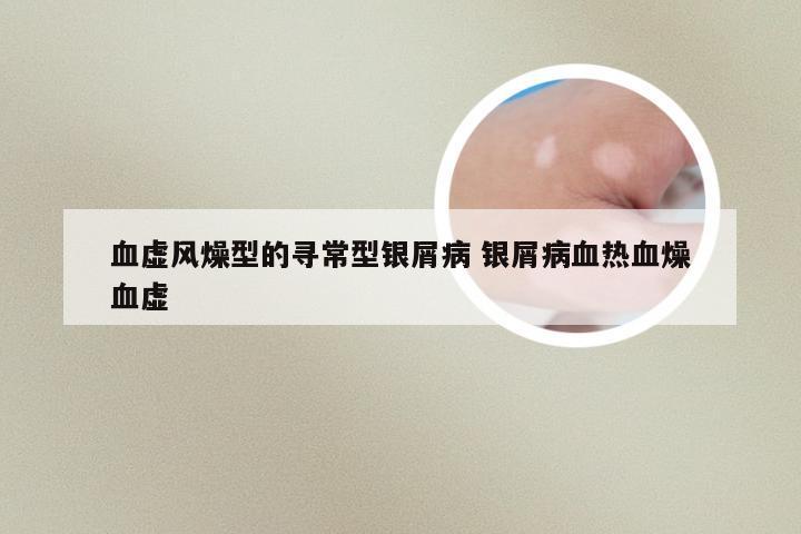 血虚风燥型的寻常型银屑病 银屑病血热血燥血虚