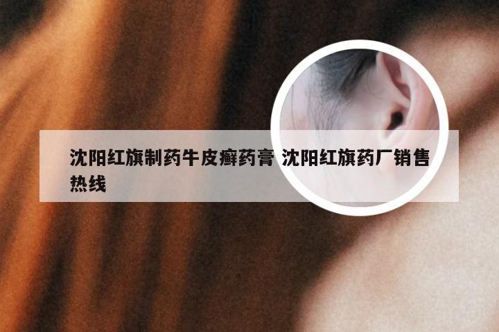 沈阳红旗制药牛皮癣药膏 沈阳红旗药厂销售热线
