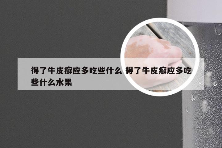 得了牛皮癣应多吃些什么 得了牛皮癣应多吃些什么水果