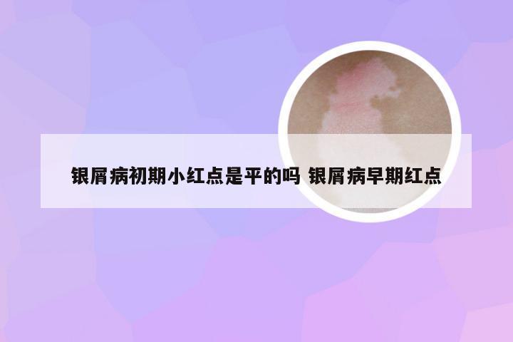 银屑病初期小红点是平的吗 银屑病早期红点