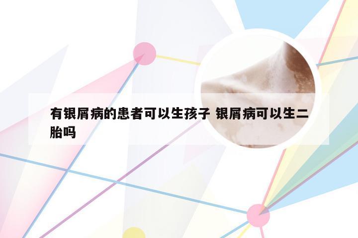 有银屑病的患者可以生孩子 银屑病可以生二胎吗