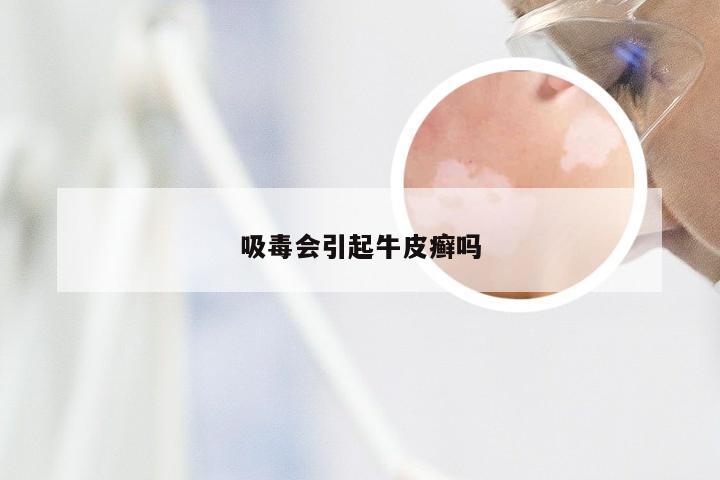 吸毒会引起牛皮癣吗