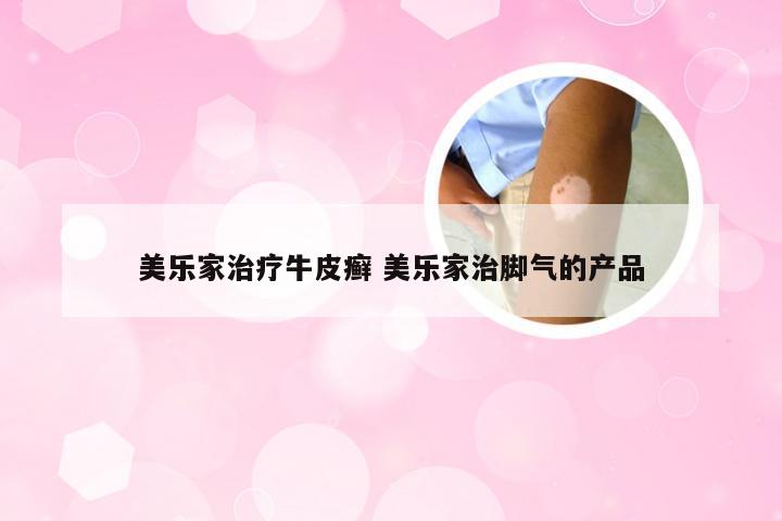 美乐家治疗牛皮癣 美乐家治脚气的产品