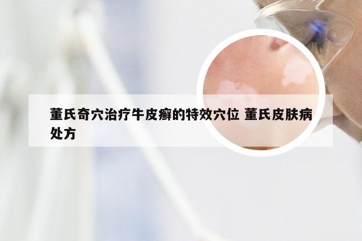 董氏奇穴治疗牛皮癣的特效穴位 董氏皮肤病处方