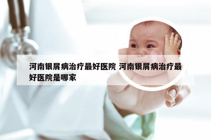 河南银屑病治疗最好医院 河南银屑病治疗最好医院是哪家