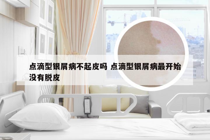 点滴型银屑病不起皮吗 点滴型银屑病最开始没有脱皮