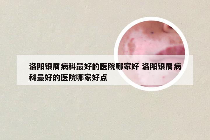 洛阳银屑病科最好的医院哪家好 洛阳银屑病科最好的医院哪家好点