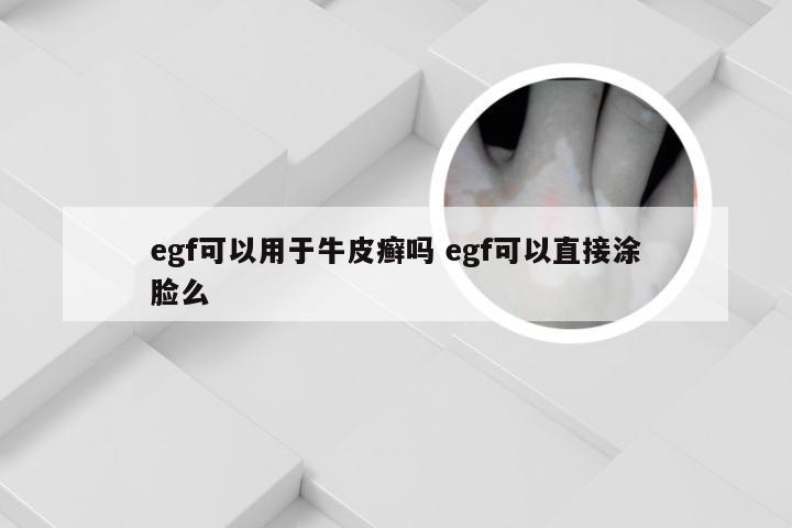 egf可以用于牛皮癣吗 egf可以直接涂脸么