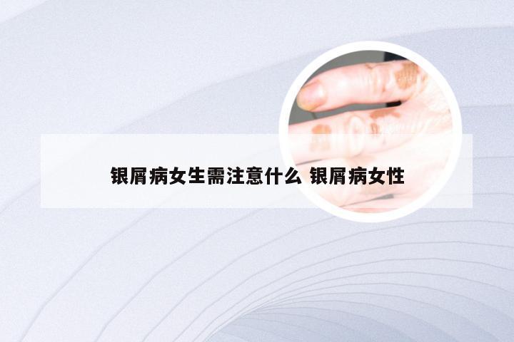 银屑病女生需注意什么 银屑病女性