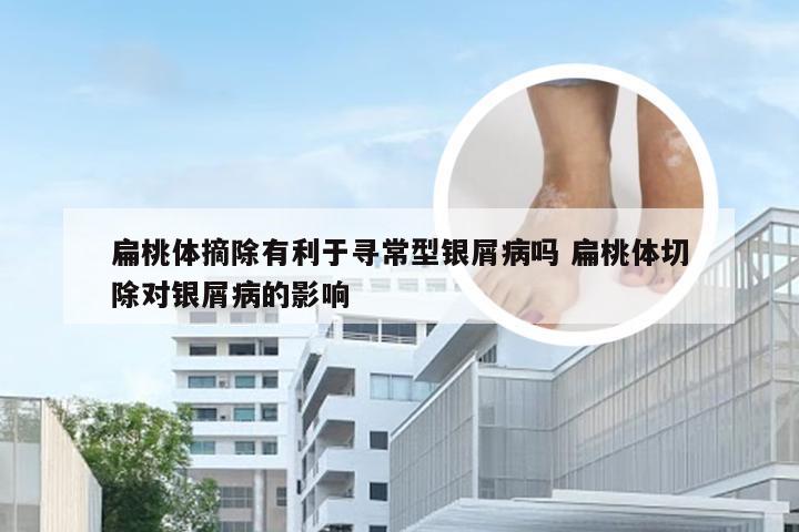 扁桃体摘除有利于寻常型银屑病吗 扁桃体切除对银屑病的影响