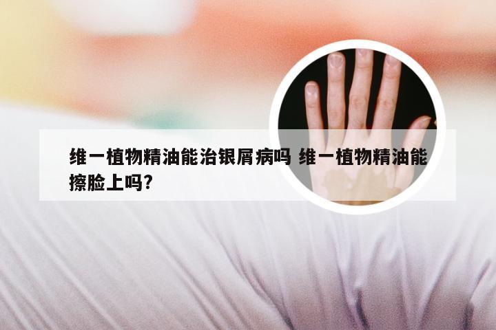 维一植物精油能治银屑病吗 维一植物精油能擦脸上吗?