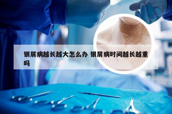 银屑病越长越大怎么办 银屑病时间越长越重吗