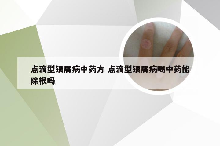 点滴型银屑病中药方 点滴型银屑病喝中药能除根吗