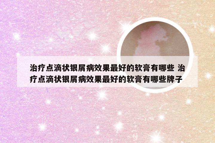 治疗点滴状银屑病效果最好的软膏有哪些 治疗点滴状银屑病效果最好的软膏有哪些牌子