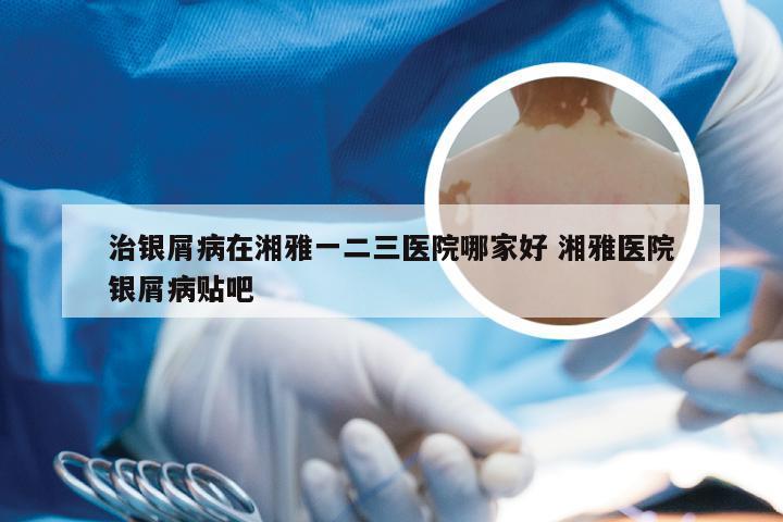 治银屑病在湘雅一二三医院哪家好 湘雅医院银屑病贴吧