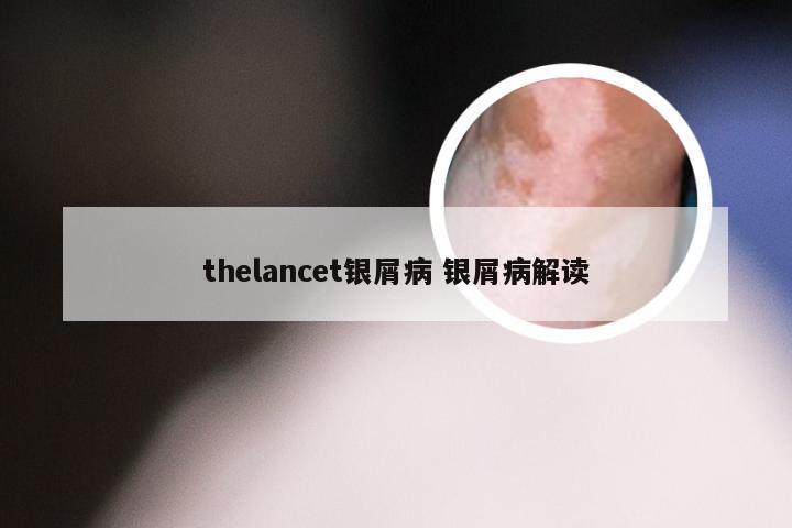thelancet银屑病 银屑病解读