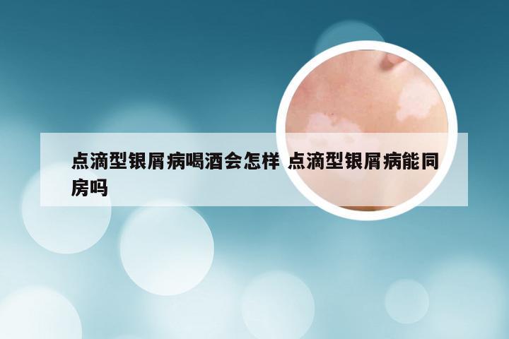 点滴型银屑病喝酒会怎样 点滴型银屑病能同房吗