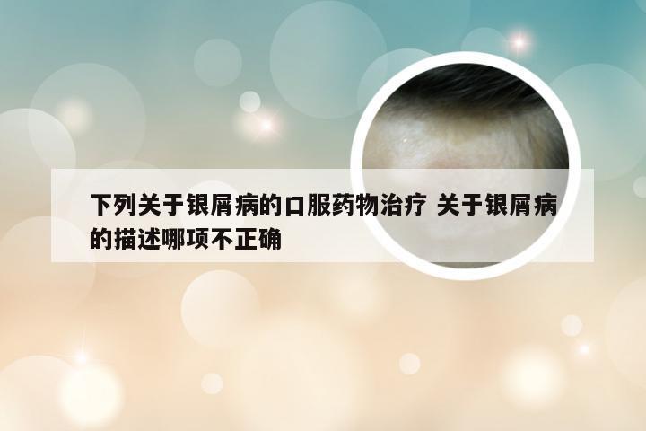 下列关于银屑病的口服药物治疗 关于银屑病的描述哪项不正确