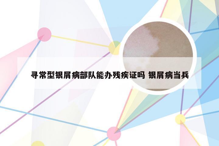 寻常型银屑病部队能办残疾证吗 银屑病当兵