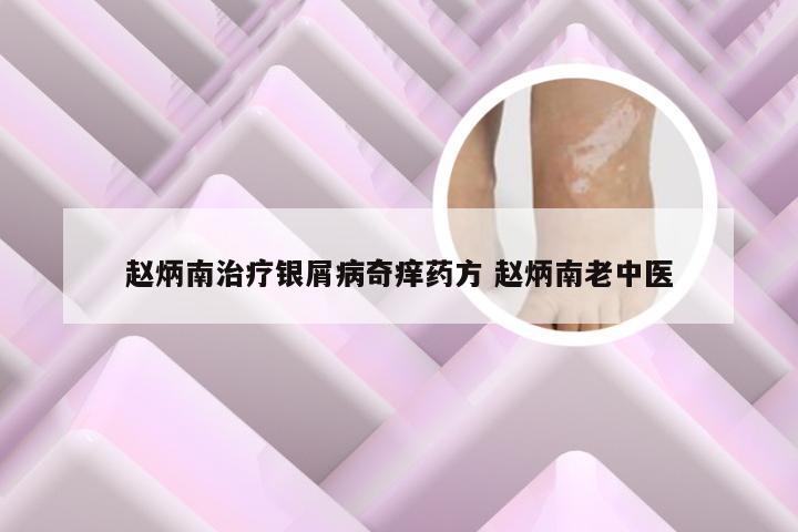 赵炳南治疗银屑病奇痒药方 赵炳南老中医