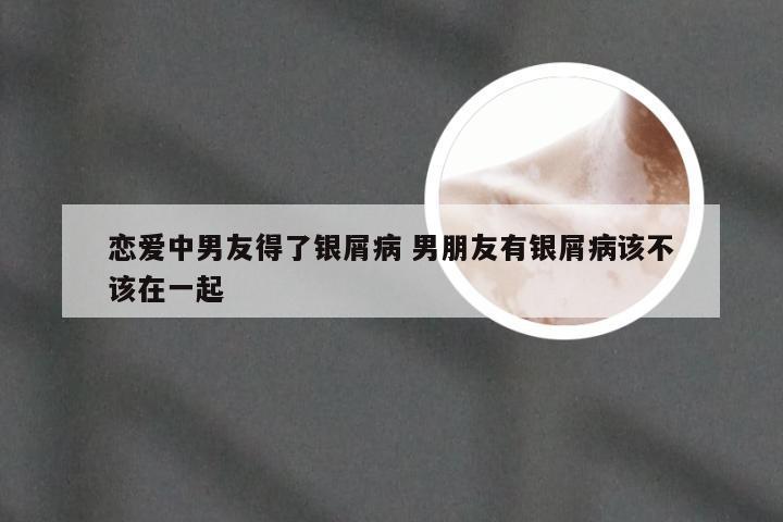 恋爱中男友得了银屑病 男朋友有银屑病该不该在一起