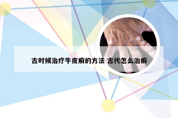 古时候治疗牛皮癣的方法 古代怎么治癣