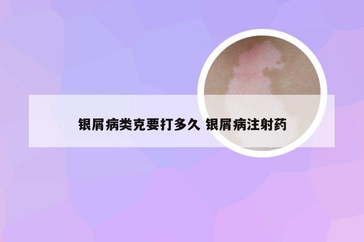 银屑病类克要打多久 银屑病注射药