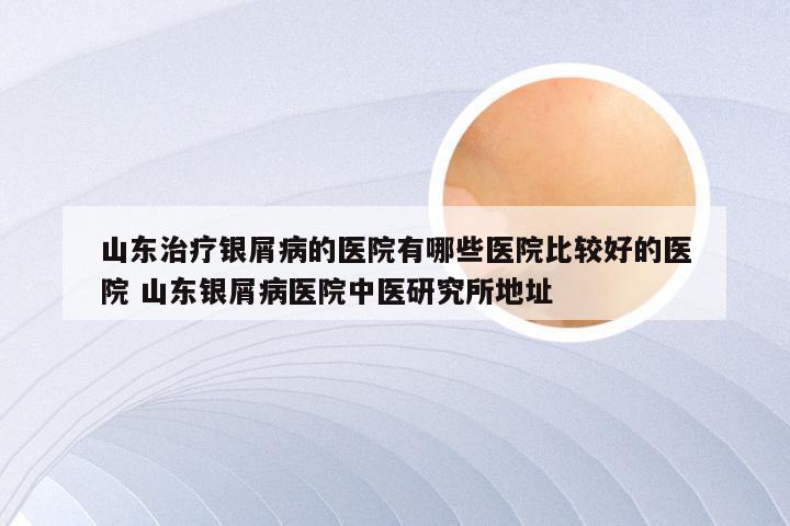 山东治疗银屑病的医院有哪些医院比较好的医院 山东银屑病医院中医研究所地址