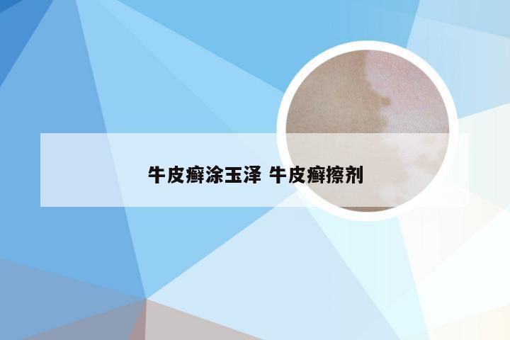 牛皮癣涂玉泽 牛皮癣擦剂