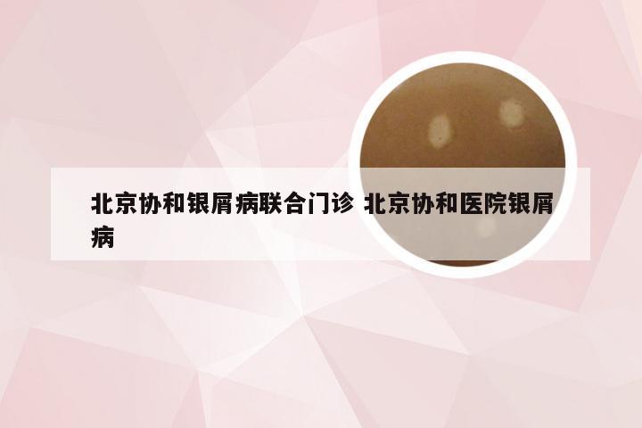 北京协和银屑病联合门诊 北京协和医院银屑病