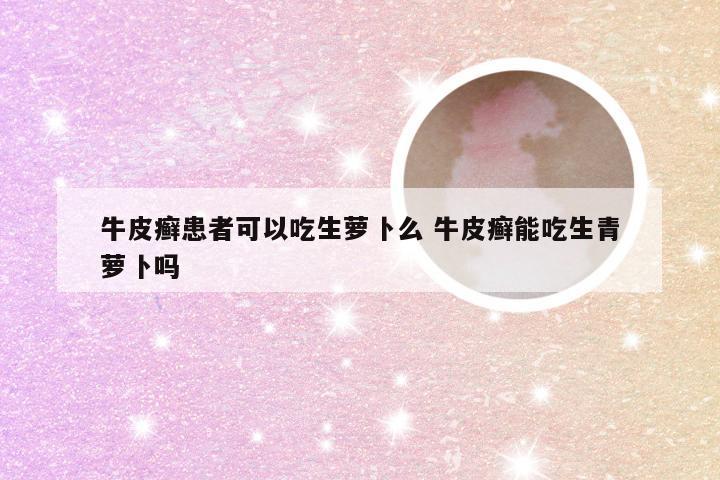 牛皮癣患者可以吃生萝卜么 牛皮癣能吃生青萝卜吗