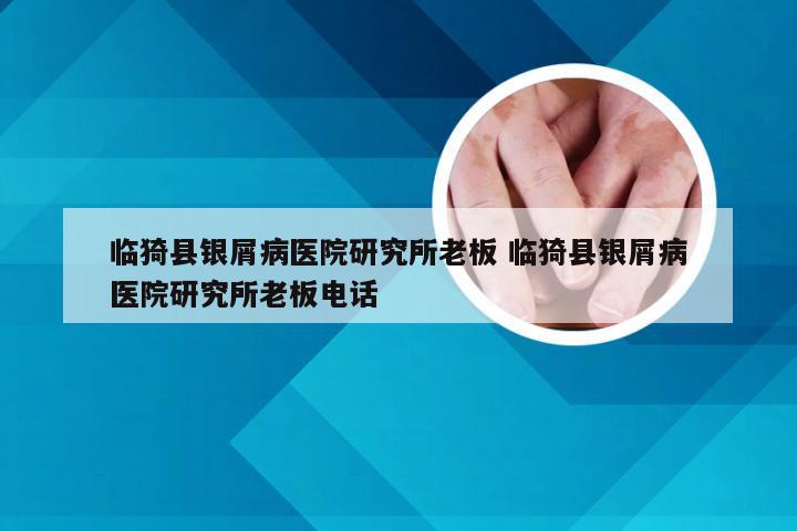 临猗县银屑病医院研究所老板 临猗县银屑病医院研究所老板电话